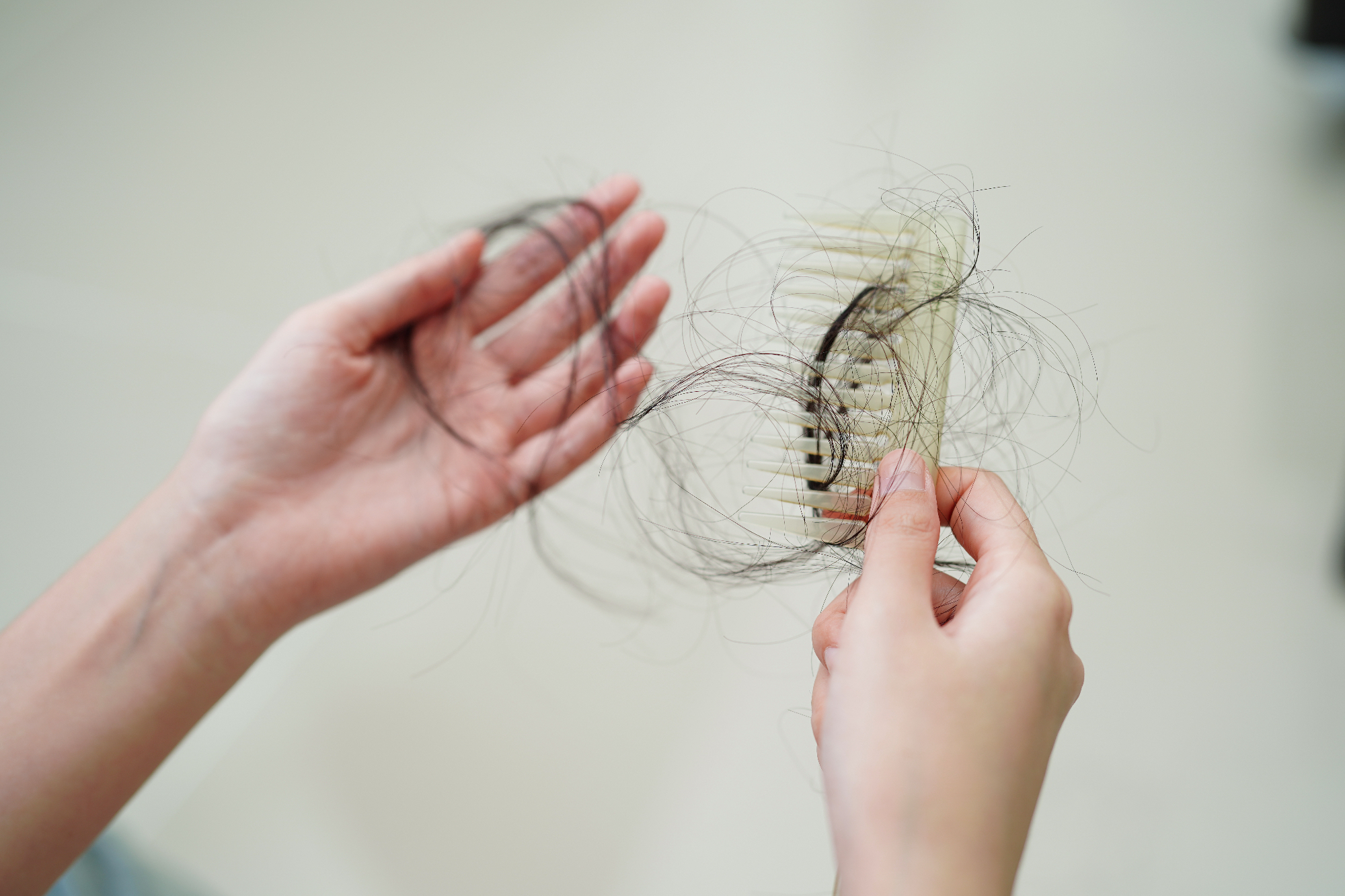 Kako preprečiti izpadanje las je res zelo pomembno vprašanje